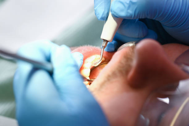 Best Emergency TMJ Treatment in Auburn, IL